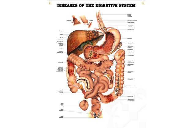 Boli ale tractului digestiv 50,8x66cm